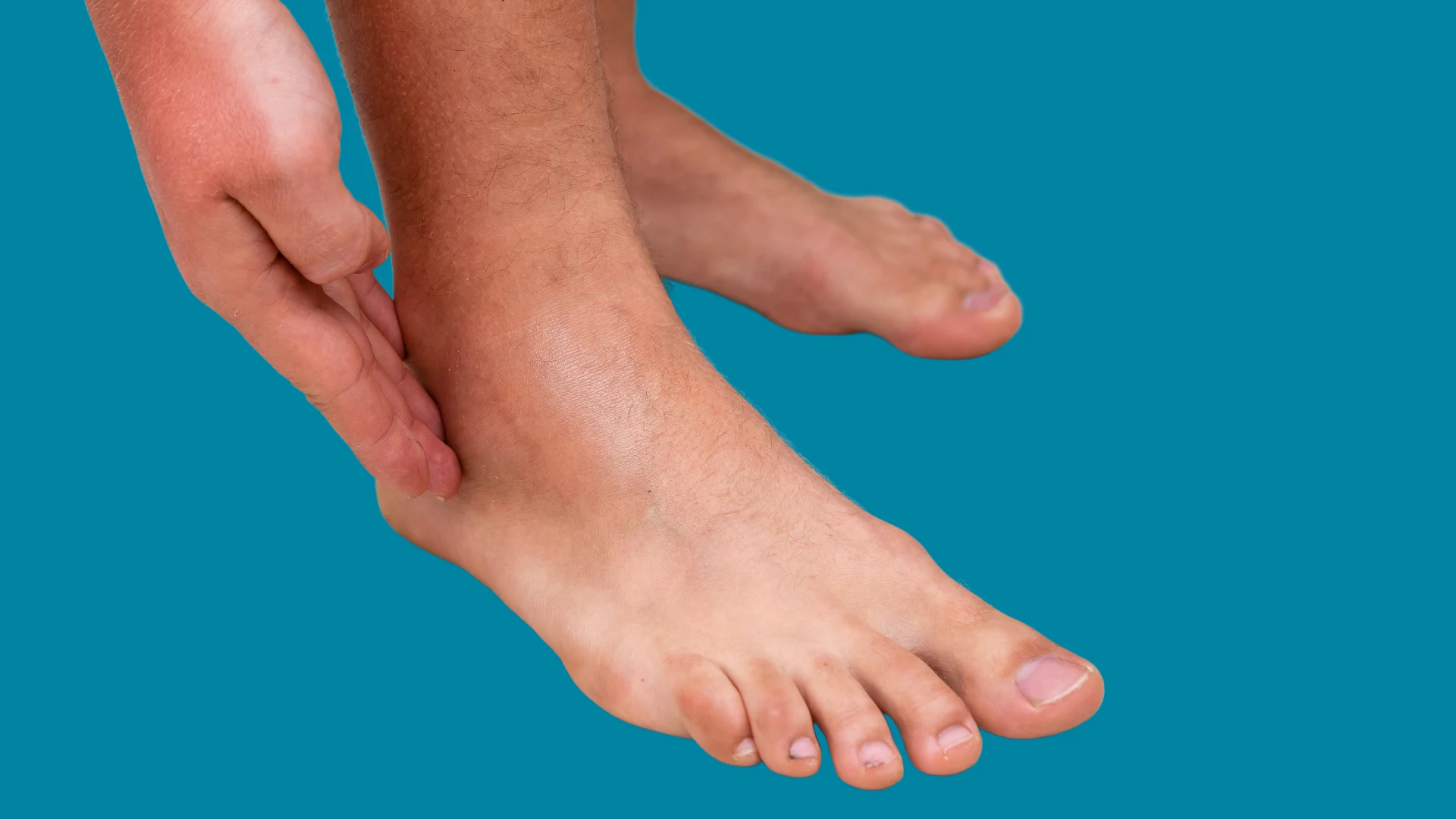 Swelling Around Ankles and Legs