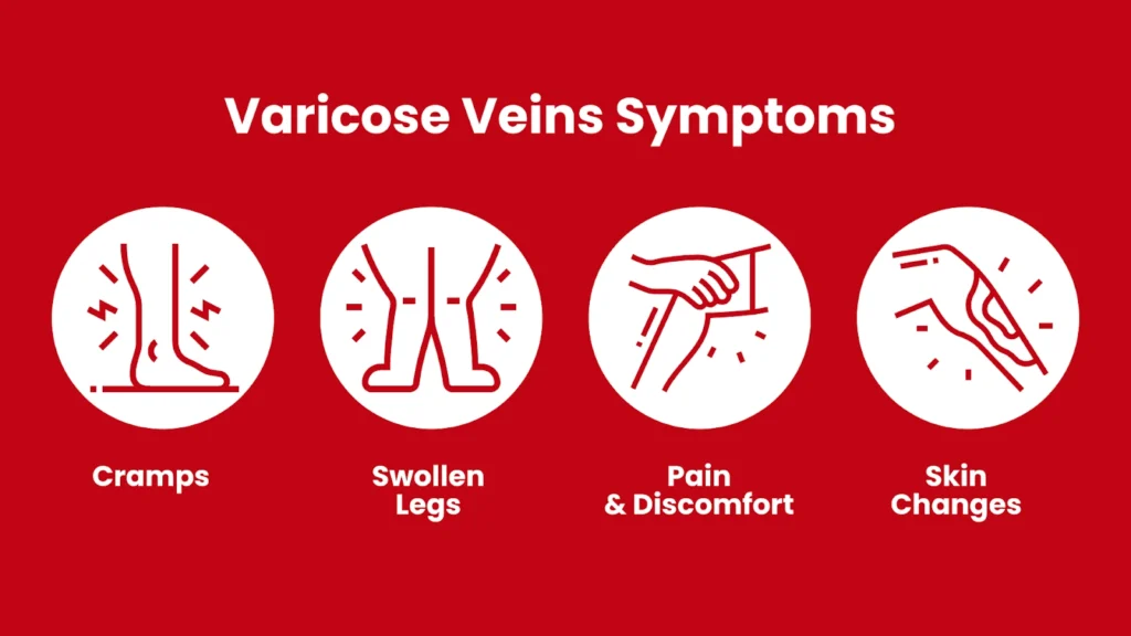 Symptoms of Varicose Veins