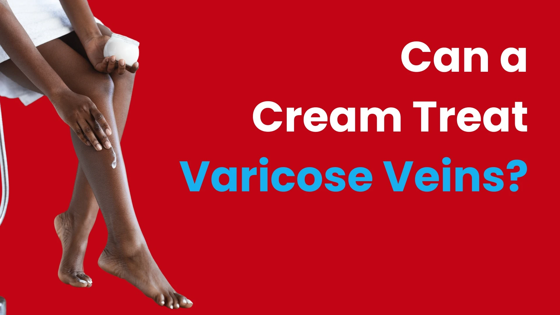 varicose vein