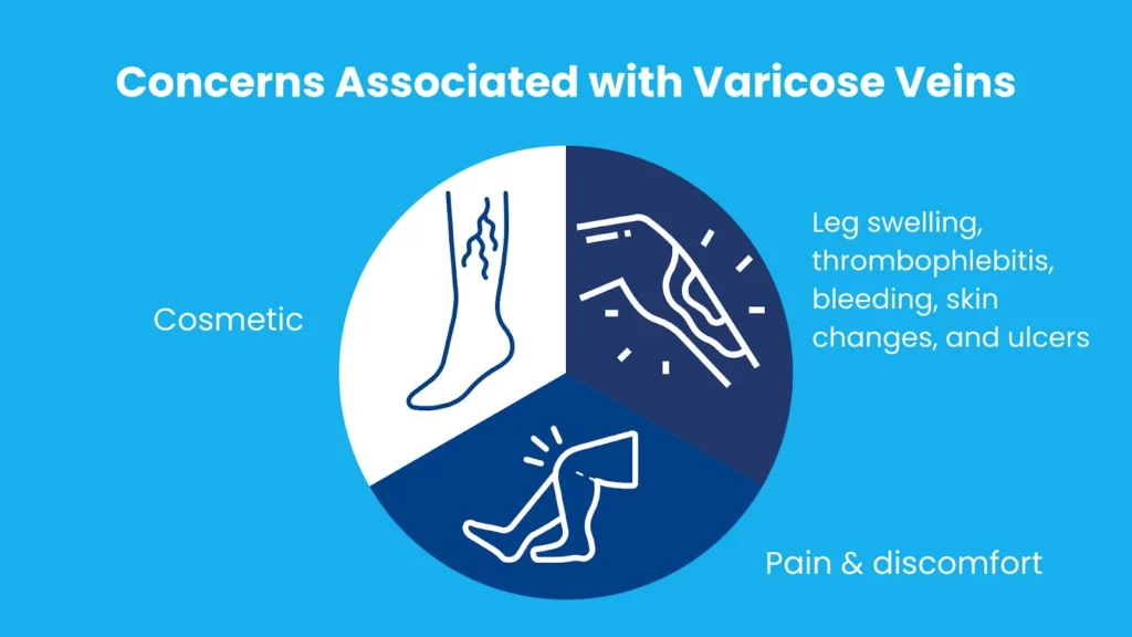 varicose vein