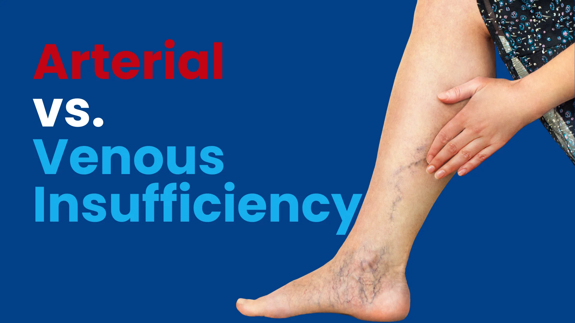 arterial vs venous insufficiency