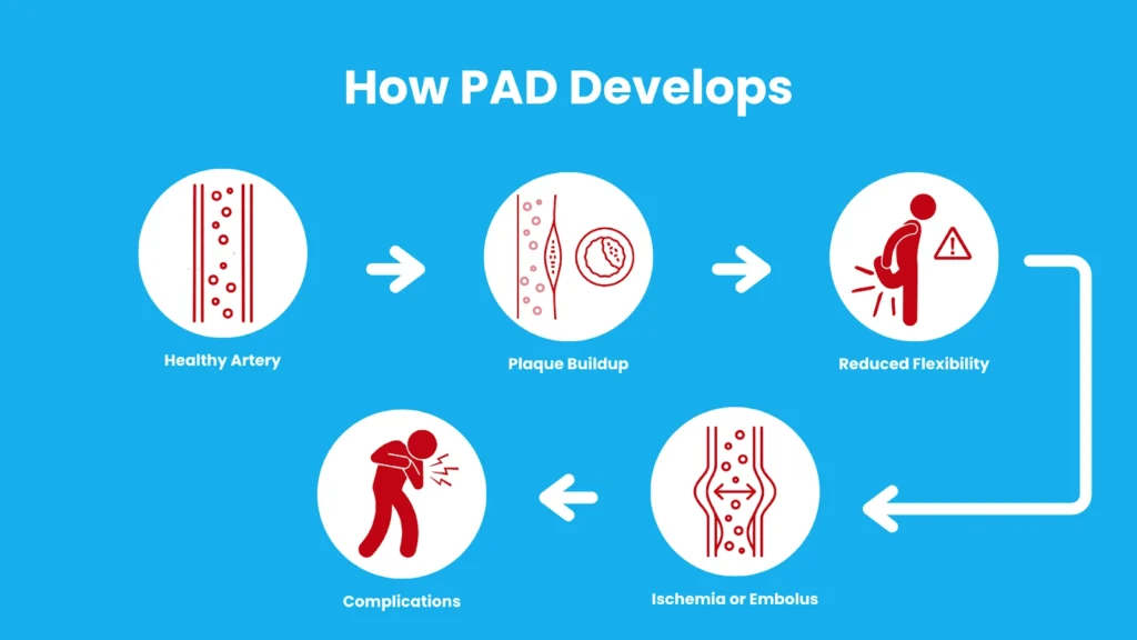 how pad develops