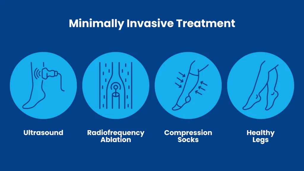 Treatment for Chronic Venous Insufficiency