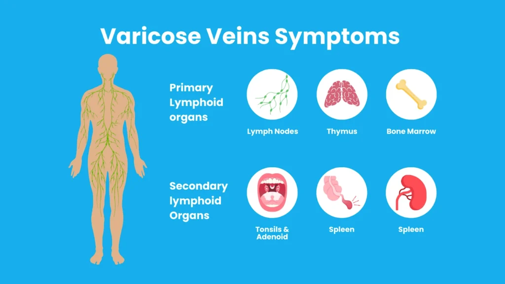 varicose vein symptoms