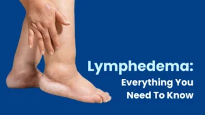 Lymphedema Diagnosis