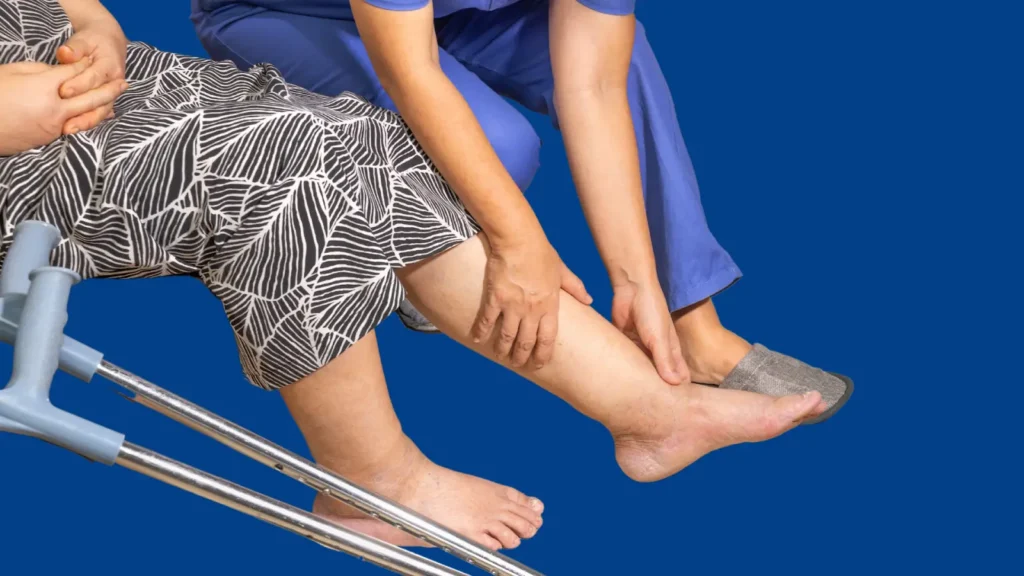 Lymphedema Diagnosis
