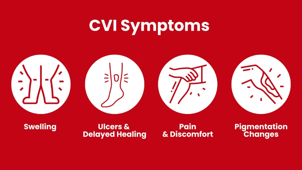 Chronic Venous Insufficiency Symptoms