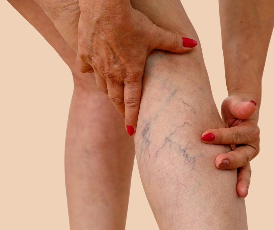 restless leg syndrome